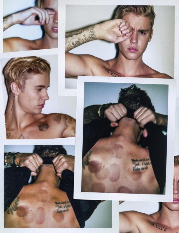 Justin hides one eye, confirming that his is an Illuminati photoshoot - the confused look on his face add to the industry victim persona they want him to embody. In the lower photos : a bunch of bruises. How is this NOT about Justin being an abused slave?